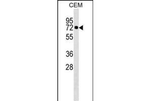 KLHL28 Antibody (C-term) (ABIN1537239 and ABIN2849863) western blot analysis in CEM cell line lysates (35 μg/lane).