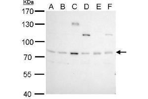 WB Image BCL6 antibody [N2C1], Internal detects BCL6 protein by Western blot analysis. (BCL6 antibody  (Internal Region))