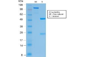 SDS-PAGE Analysis Purified CFTR Rabbit Recombinant Monoclonal Antibody (CFTR/2290R). (Recombinant CFTR antibody)
