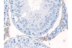 Detection of MEC in Rat Testis Tissue using Polyclonal Antibody to Mucosae Associated Epithelia Chemokine (MEC) (Mucosae Associated Epithelia Chemokine (AA 29-131) antibody)