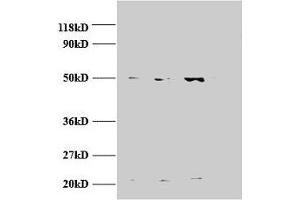 Western blot All lanes: AP2M1 antibody at 2 μg/mL Lane 1: Jurket whole cell lysate Lane 2: U87 whole cell lysate Lane 3: U251 whole cell lysate Secondary Goat polyclonal to rabbit IgG at 1/15000 dilution Predicted band size: 50 kDa Observed band size: 50, 22 kDa (AP2M1 antibody  (AA 1-435))