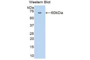 Western Blotting (WB) image for anti-Amylase 1, Salivary (AMY1) (AA 16-511) antibody (ABIN1857978) (Alpha-amylase 1 antibody  (AA 16-511))