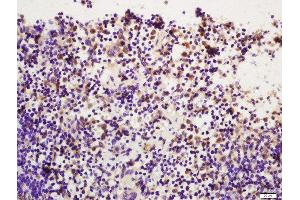 Formalin-fixed and paraffin embedded mouse spleen labeled with Rabbit Anti-PI 3 Kinase p110 delta (Tyr524) Polyclonal Antibody  at 1:200 followed by conjugation to the secondary antibody and DAB staining (PIK3CD antibody  (pTyr524))