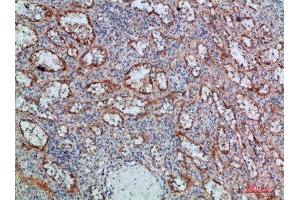 Immunohistochemical analysis of paraffin-embedded human-spleen, antibody was diluted at 1:200 (LTB antibody  (AA 41-90))