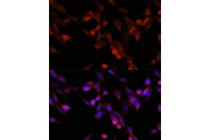 Immunofluorescence analysis of NIH/3T3 cells using UBI antibody (ABIN6134945, ABIN6149844, ABIN6149847 and ABIN6218504) at dilution of 1:100. (UBIAD1 antibody  (AA 1-100))