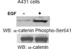 Image no. 1 for anti-Catenin (Cadherin-Associated Protein), alpha 1, 102kDa (CTNNA1) (Ser641) antibody (ABIN319361) (CTNNA1 antibody  (Ser641))