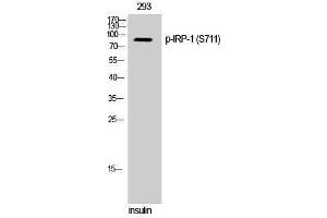 Western Blotting (WB) image for anti-Aconitase 1 (ACO1) (pSer711) antibody (ABIN3182636) (Aconitase 1 antibody  (pSer711))