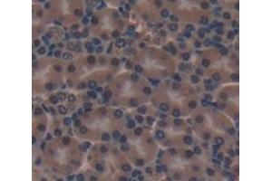 #VALUE! (KLF10/TIEG1 antibody  (AA 206-473))