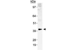 Western blot analysis of SLC2A1 in a human kidney membrane prep with SLC2A1 polyclonal antibody .