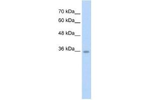 WB Suggested Anti-C6orf134 Antibody Titration:  2.