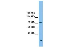 ARHGAP30 antibody used at 1 ug/ml to detect target protein. (ARHGAP30 antibody  (N-Term))