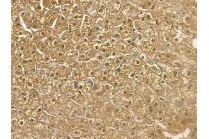 USP21 Mouse Monoclonal Antibody at 1/100 staining human normal liver tissue by IHC-P.