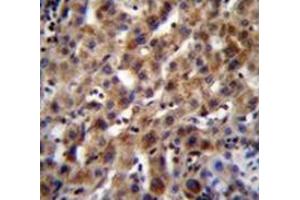 Immunohistochemistry analysis in human liver tissue (Formalin-fixed, Paraffin-embedded) using SPACA5B Antibody (N-term), followed by peroxidase conjugation of the secondary antibody and DAB staining. (SPACA5B antibody  (N-Term))
