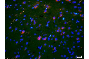Formalin-fixed and paraffin-embedded rat brain labeled with Anti-OB/CDH11/OB-Cadherin Polyclonal Antibody, Unconjugated (ABIN1387539) 1:200, overnight at 4°C, The secondary antibody was Goat Anti-Rabbit IgG, Cy3 conjugated used at 1:200 dilution for 40 minutes at 37°C. (OB Cadherin antibody  (AA 310-360))
