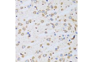 Immunohistochemistry of paraffin-embedded rat brain using PTRH2 antibody. (PTRH2 antibody  (AA 40-179))