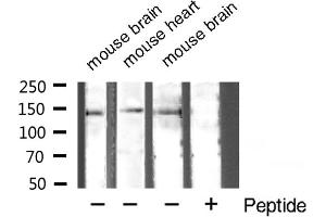 Western blot analysis of TSC1 expression in various cell lysate (TSC1 antibody  (C-Term))