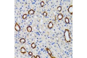 Immunohistochemistry of paraffin-embedded rat kidney using GABARAP antibody (ABIN6129966, ABIN6140874, ABIN6140877 and ABIN6221250) at dilution of 1:100 (40x lens).