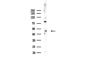 anti-ST8 alpha-N-Acetyl-Neuraminide alpha-2,8-Sialyltransferase 2 (ST8SIA2) (C-Term) antibody