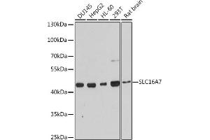 Western blot analysis of extracts of various cell lines, using SLC16 antibody (ABIN3017189, ABIN3017190, ABIN3017191 and ABIN6219987) at 1:3000 dilution. (SLC16A7 antibody  (C-Term))