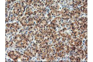 Image no. 1 for anti-1-Acylglycerol-3-Phosphate O-Acyltransferase 5 (Lysophosphatidic Acid Acyltransferase, Epsilon) (AGPAT5) antibody (ABIN1496498) (AGPAT5 antibody)