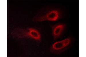 ABIN6267565 staining HeLa cells treated with PMA 125ng/ml 30' by ICC/IF. (14-3-3 zeta antibody  (pSer58))