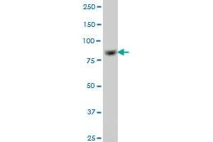 RPS6KA6 monoclonal antibody (M05A), clone 3E2. (RPS6KA6 antibody  (AA 636-745))