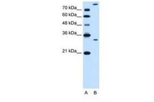 Image no. 1 for anti-Granzyme K (Granzyme 3, Tryptase II) (GZMK) (AA 78-127) antibody (ABIN6738148)