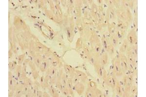 Immunohistochemistry of paraffin-embedded human heart tissue using ABIN7165964 at dilution of 1:100 (PPM1M antibody  (AA 1-247))