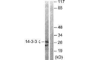Western blot analysis of extracts from 293 cells treated with Forskolin (40nM, 30min) using 14-3-3 ζ (Ab-58) antibody (#B0001, Linand 2). (14-3-3 zeta antibody  (Ser58))