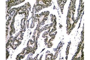 IHC analysis of NFIA using anti-NFIA antibody (ABIN6719349). (NFIA antibody  (Middle Region))