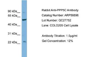 Western Blotting (WB) image for anti-Protein Phosphatase 5, Catalytic Subunit (PPP5C) (Middle Region) antibody (ABIN2774158) (PP5 antibody  (Middle Region))