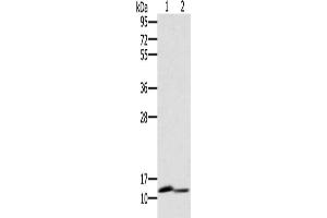 Gel: 10 % SDS-PAGE, Lysate: 40 μg, Lane 1-2: Mouse brain tissue, Mouse kidney tissue, Primary antibody: ABIN7130528(PAGE2 Antibody) at dilution 1/400, Secondary antibody: Goat anti rabbit IgG at 1/8000 dilution, Exposure time: 1 minute (PAGE2 antibody)