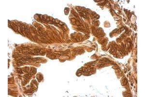 Immunohistochemistry (IHC) image for anti-Matrix Metallopeptidase 17 (Membrane-inserted) (MMP17) antibody (ABIN2856073)