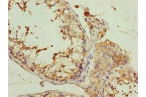 Immunohistochemistry of paraffin-embedded human testis tissue using ABIN7152171 at dilution of 1:100 (Eukaryotic Translation Initiation Factor 3, Subunit M (EIF3M) (AA 1-374) antibody)