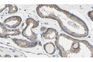 ABIN6273587 at 1/100 staining Human prostate tissue by IHC-P. (TCHP antibody  (C-Term))