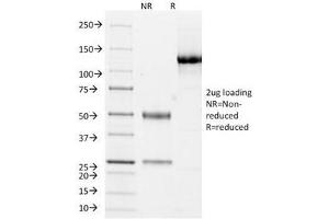 SDS-PAGE Analysis of Purified, BSA-Free Cytokeratin 10/13 Antibody (clone DE-K13). (Keratin 10/13 antibody)