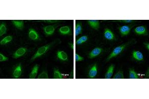 ICC/IF Image FACL4 antibody [C3], C-term detects FACL4 protein at endoplasmic reticulum by immunofluorescent analysis. (ACSL4 antibody  (C-Term))