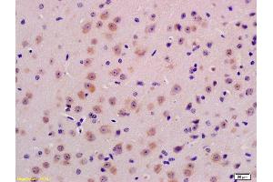 Formalin-fixed and paraffin embedded mouse brain labeled with Anti-PPT1 Polyclonal Antibody, Unconjugated (ABIN718946) at 1:200 followed by conjugation to the secondary antibody and DAB staining (PPT1 antibody  (AA 188-290))