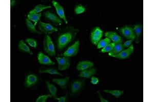 Immunofluorescence staining of A549 cells with ABIN7142230 at 1:530, counter-stained with DAPI. (PSMC3 antibody  (Regulatory Subunit 6A))
