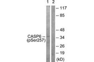 Western blot analysis of extracts from 293 cells treated with Etoposide 25uM 60', using Caspase 6 (Phospho-Ser257) Antibody. (Caspase 6 antibody  (pSer257))