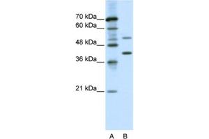 Western Blotting (WB) image for anti-REX4, RNA Exonuclease 4 Homolog (REXO4) antibody (ABIN2460618) (REXO4 antibody)