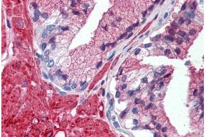 Human Prostate (formalin-fixed, paraffin-embedded) stained with TRAF2 antibody ABIN297934 at 5 ug/ml followed by biotinylated anti-mouse IgG secondary antibody ABIN481714, alkaline phosphatase-streptavidin and chromogen. (TRAF2 antibody  (AA 205-222))