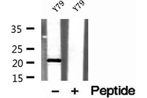 Western blot analysis of extracts of Y79 cells, using TAF12 antibody. (TAF12 antibody  (N-Term))