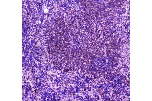 Immunohistochemistry (IHC) image for anti-Phospholipase C gamma 2 (PLCG2) (AA 1201-1258) antibody (ABIN5692854)