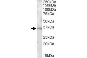 BTLA polyclonal antibody  (1 ug/mL) staining of mouse spleen lysate (35 ug protein in RIPA buffer). (BTLA antibody)