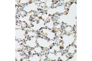 Immunohistochemistry (IHC) image for anti-Toll-Like Receptor 1 (TLR1) (AA 30-290) antibody (ABIN3023655)