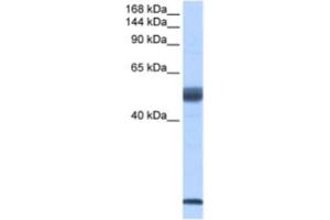 Western Blotting (WB) image for anti-Pre-mRNA Branch Site Protein p14 (SF3B14) antibody (ABIN2462263) (Pre-mRNA Branch Site Protein p14 (SF3B14) antibody)