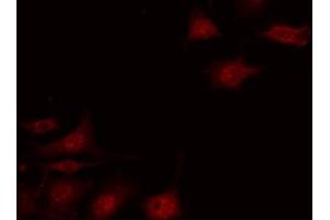 ABIN6267673 staining HepG2 by IF/ICC. (PDCD4 antibody  (pSer67))