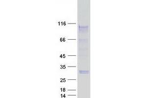 Validation with Western Blot