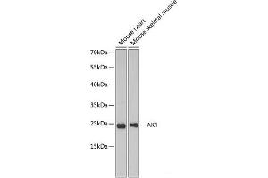 Western blot analysis of extracts of various cell lines using AK1 Polyclonal Antibody at dilution of 1:1000. (Adenylate Kinase 1 antibody)